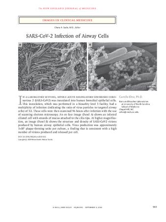 SARS-CoV-2 Infection of Airway Cells thumbnail