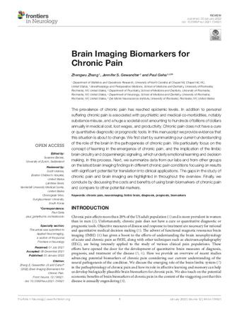 Brain Imaging Biomarkers for Chronic Pain thumbnail
