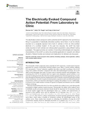 The Electrically Evoked Compound Action Potential: From Laboratory to Clinic thumbnail