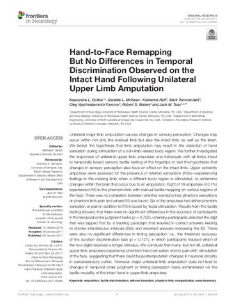 Hand-to-Face Remapping But No Differences in Temporal Discrimination Observed on the Intact Hand Following Unilateral Upper Limb Amputation thumbnail